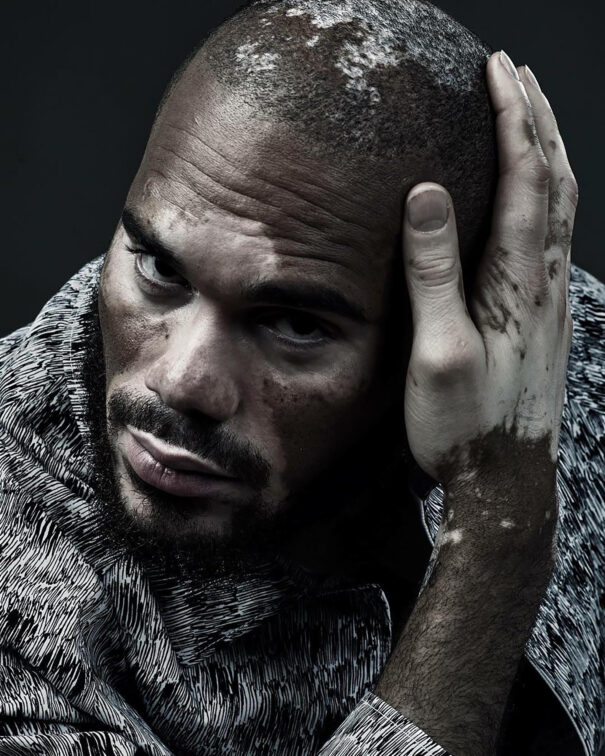 Man with textured patterned shirt, hand on head, dark background.